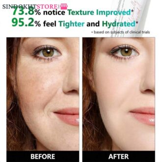 سرم Dark spot اکسیس وای