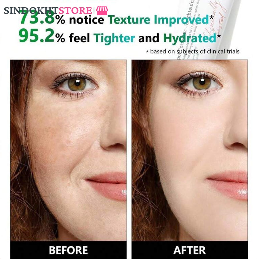 سرم Dark spot اکسیس وای